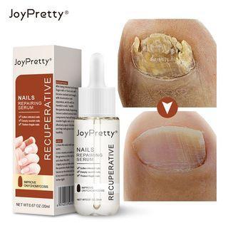 Fungus-Free Nails & Toes: Revitalize and Whiten with JOYPRETTY Care Elixir! Treatments - Ainna Store