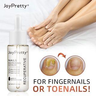 Fungus-Free Nails & Toes: Revitalize and Whiten with JOYPRETTY Care Elixir! Treatments - Ainna Store