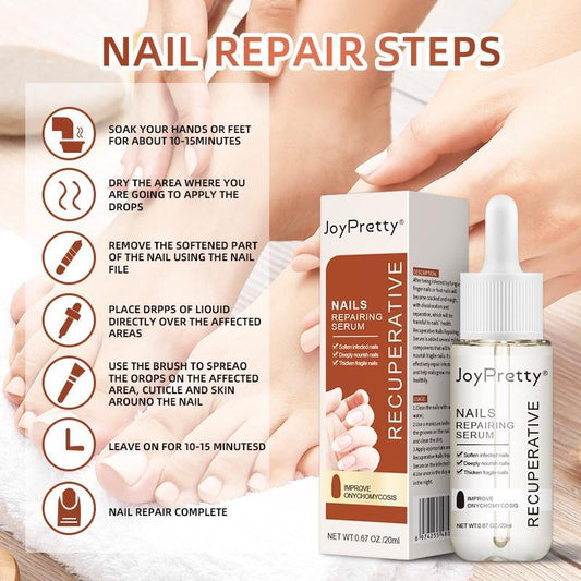 Fungus-Free Nails & Toes: Revitalize and Whiten with JOYPRETTY Care Elixir! Treatments - Ainna Store